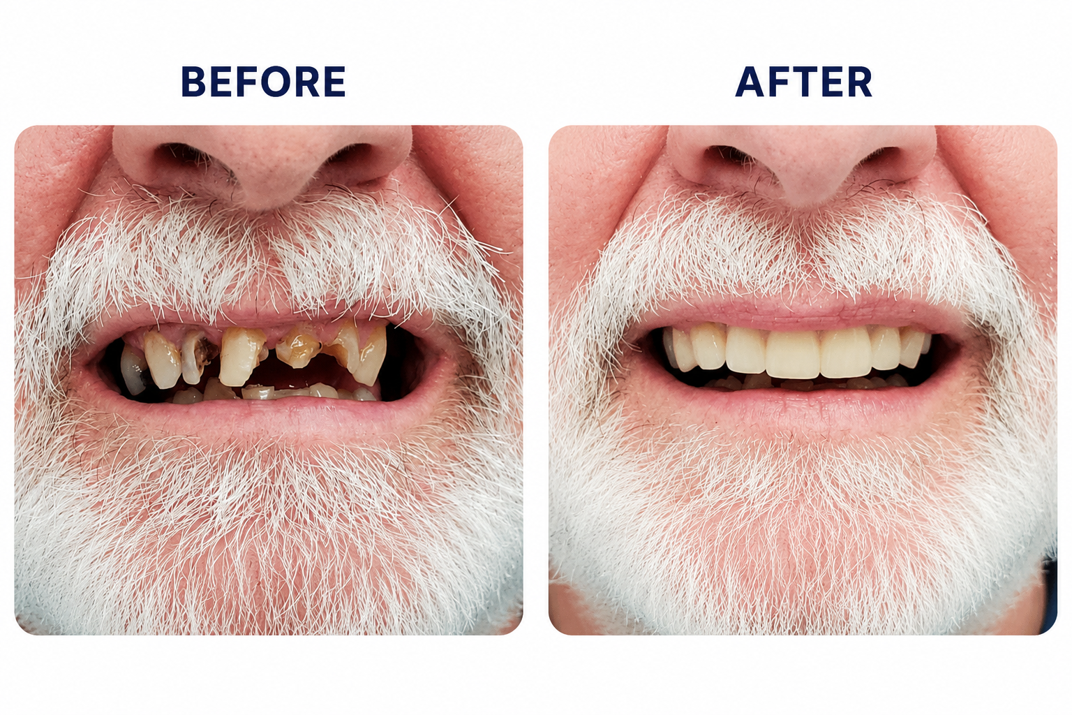 Before and after teeth restoration dental case in Las Vegas Nevada