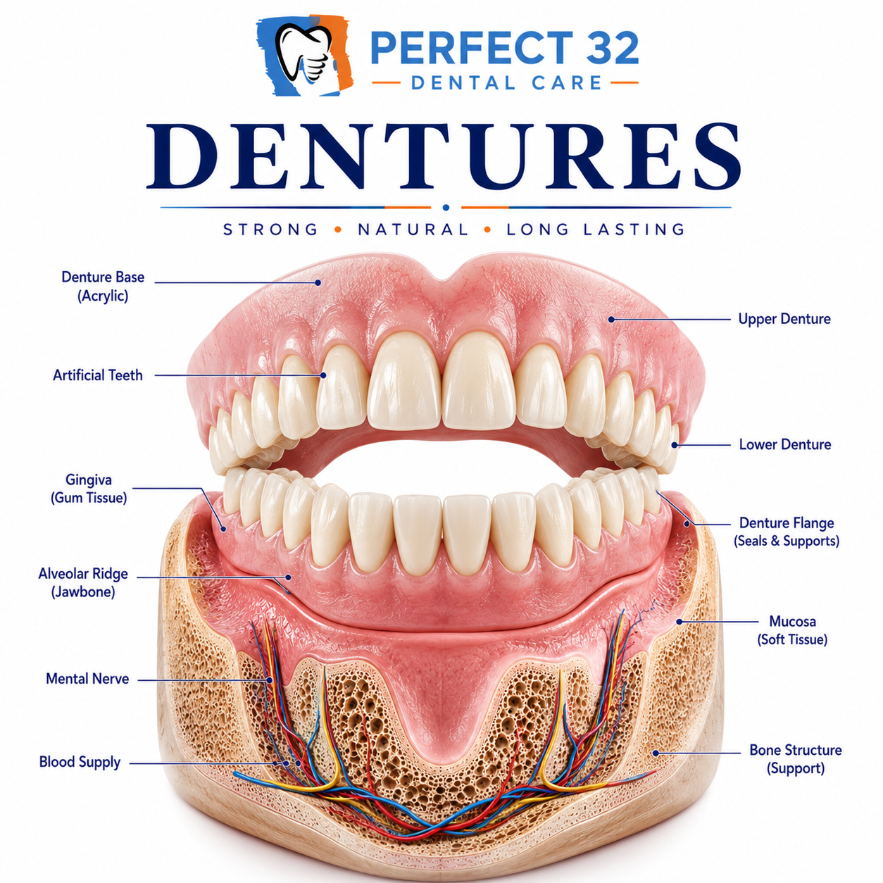 Dentures - Perfect 32 Dental Care